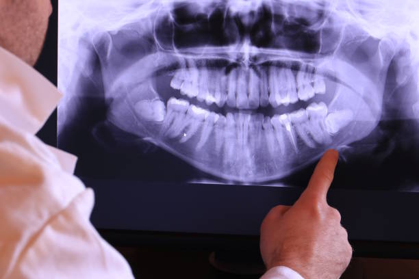 Best Emergency Dental Care for Broken or Chipped Teeth in Clearlake Riviera, CA